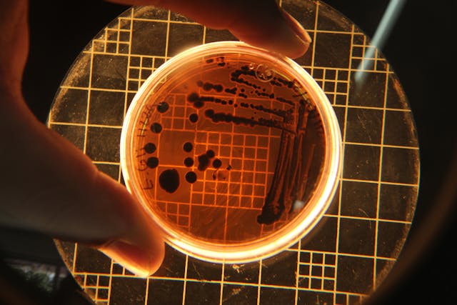 Biological ingredients and growth mediums used in vaccine production