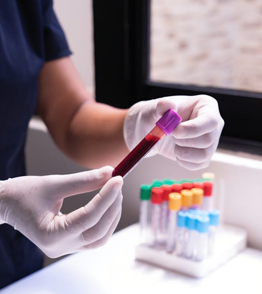 Veterinary blood test used for canine titer evaluation